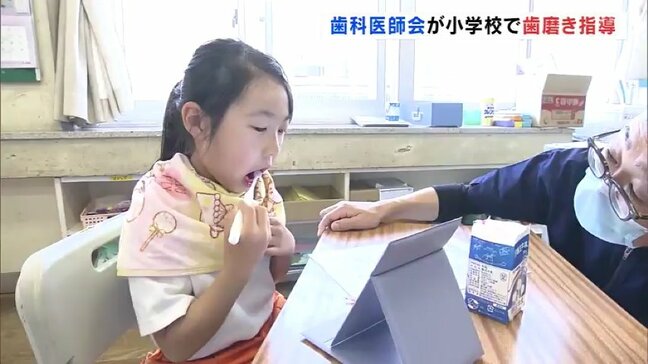 虫歯がある小学生は約4割…歯科医師会が歯みがき指導 6月4日~10日は「歯と口の健康週間」福島|TBS NEWS DIG