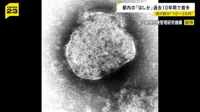 10年間で過去最多の132人 　都内の「はしか」感染者　10代～30代が9割近く|TBS NEWS DIG