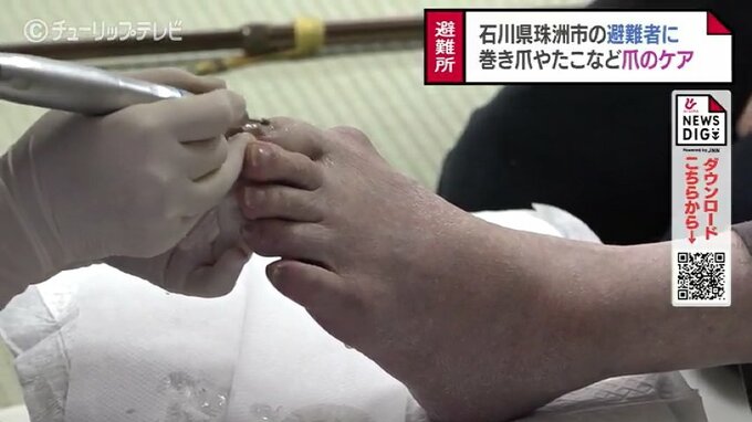 足の巻き爪やたこを防ぐ…ネイルケアで避難生活を健康に　珠洲市の二次避難者向けにサービス　富山　|　富山のニュース｜天気・防災｜チューリップテレビ