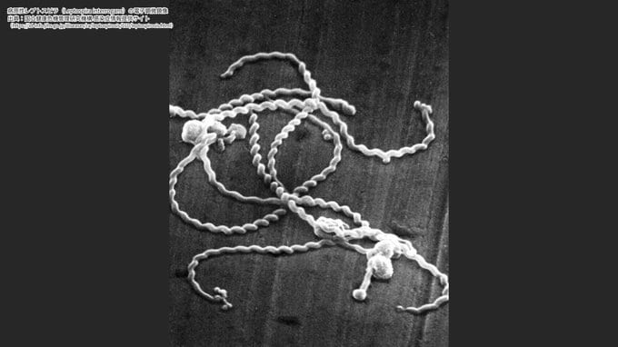 ネズミやイノシシの尿から感染するレプトスピラ症　川で遊泳し集団感染、10代男性5人が入院　3年前には死亡例も　|　沖縄のニュース｜RBC 琉球放送