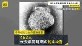 はしか感染者数462人　東京都が半分ほど占める|TBS NEWS DIG