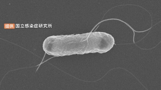 新たに幼児13人…合計43人に　児童福祉施設でO1５7感染症集団発生　2人が重篤化…HUS（溶血性尿毒症症候群）とは　|　BSSニュース | BSS山陰放送