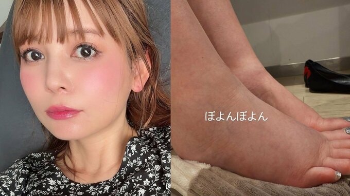 【中川翔子】最近の悩みは「むくみがエグい」と告白　「毎日自分の身体と闘っているかんじ」今月上旬に第一子妊娠を公表|TBS NEWS DIG