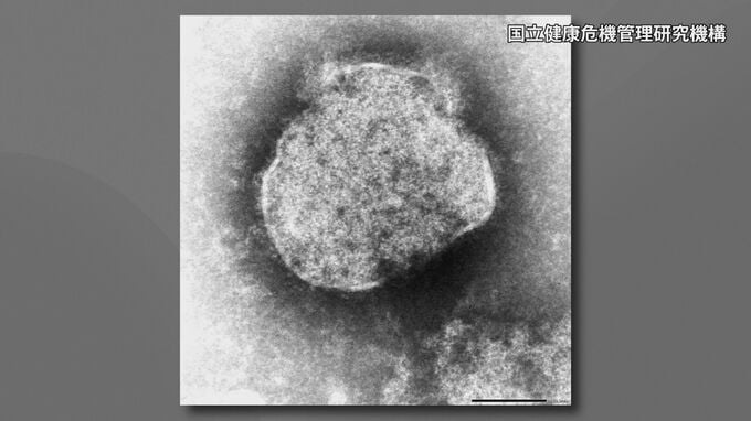 「はしか」の感染者数　今年に入り累計100人に　前年同時期の4倍以上|TBS NEWS DIG