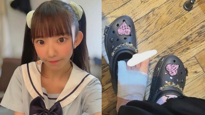 長澤茉里奈さん　足の骨折を報告「小指のくせに全治2ヶ月！！！泣」【まりちゅう】|TBS NEWS DIG