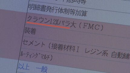 銀歯1本で5000円赤字？“金パラ”価格高騰に「チェックしないと怖い