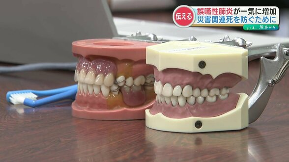 避難生活で"口の中を清潔に保つ"重要性 10年前の熊本地震『災害関連死』の最多は誤嚥性肺炎ふくむ「呼吸器系の疾患」だった|TBS NEWS DIG