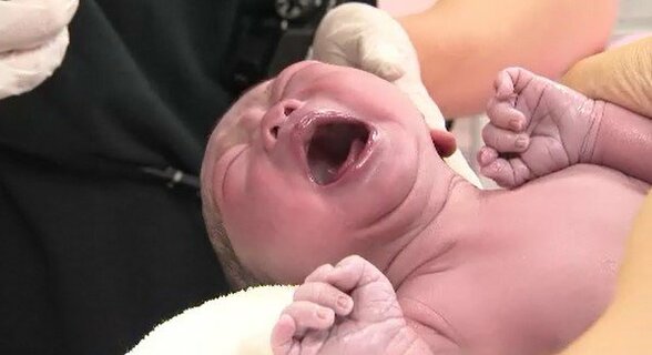 “痛みをやわらげる出産”という選択　麻酔を使う「無痛分娩」とは　「自然分娩にはないリスクの理解も必要」東京都は独自の助成制度を開始　関心高まる「無痛分娩」に密着　|　SBC NEWS | 長野のニュース | SBC信越放送