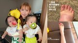 【 中川翔子 】双子が生後11か月「もう0歳でいられるのがあとわずか!尊い!」 絵日記で成長を報告 「むくみMAX足」と「マイナス29.5キロ減の足」も公開|TBS NEWS DIG