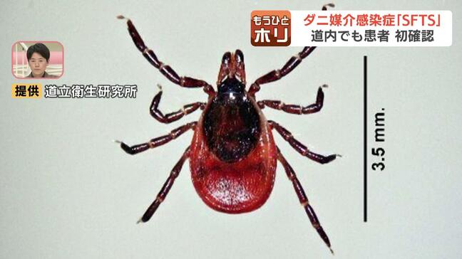 全国患者数が過去最多135人に…北海道でも初確認  マダニ感染症「SFTS」　重症化すると死亡するおそれも 専門家に聞いた！症状と対策|TBS NEWS DIG