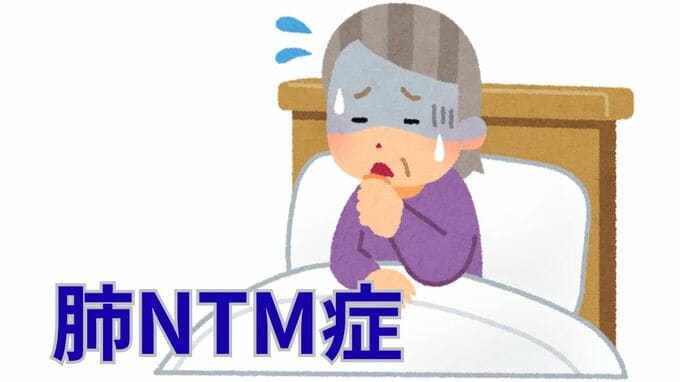 【長引く咳・痰・倦怠感・体重減少など】「肺ＮＴＭ症」の診断は？「菌がみつかった＝診断確定」ではない【徹底解説②診断】|TBS NEWS DIG