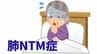 【長引く咳・痰・倦怠感・体重減少など】「肺ＮＴＭ症」の診断は？「菌がみつかった＝診断確定」ではない【徹底解説②診断】　|　岡山・香川のニュース | 天気 | RSK山陽放送