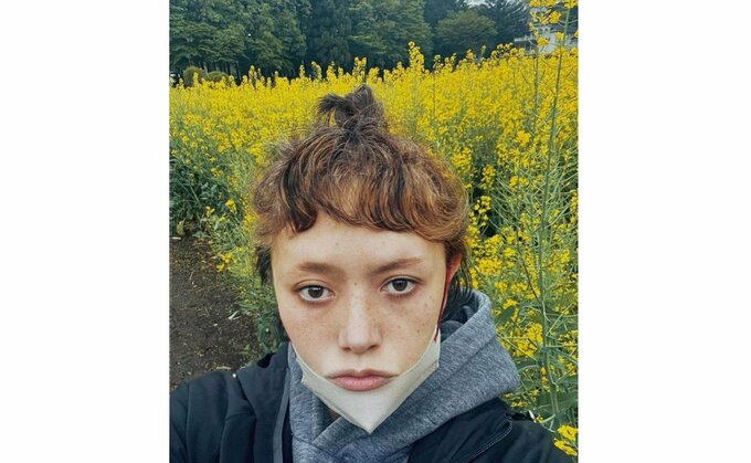 広田レオナさん　「咳喘息の発作」で「喘息の数値が振り切れてる重症に」　自身の状況明かす|TBS NEWS DIG