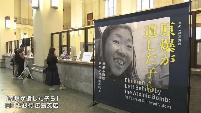 「どういう苦しみをしたのか知ってほしい」原爆小頭症写真展が広島市で始まる|TBS NEWS DIG