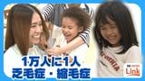 1万人に1人の乏毛症・縮毛症の少女 人毛のウィッグを受け取った母親も美容室の鏡の前に座った…自身も3年伸ばした髪を寄付 | 沖縄のニュース|RBC 琉球放送