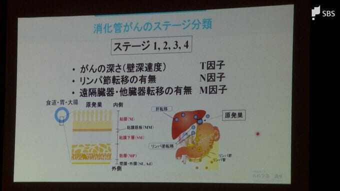 「早期発見・早期治療を」9月はがん征圧月間 静岡市でがん征圧大会|TBS NEWS DIG