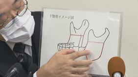 「早い時点で医師に相談していれば…」 下あごの手術受けた10代女性患者 医療事故で死亡 愛媛県立中央病院|TBS NEWS DIG