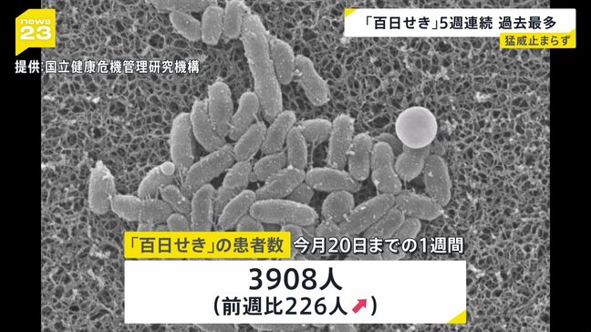「百日せき」の患者数が5週連続で過去最多を更新　最多は東京で310人|TBS NEWS DIG