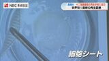 ”生きた絆創膏” 最新再生医療「本人の細胞から作られた細胞シート使った消化器官治療」に世界で初めて成功 長崎大 | 長崎のニュース | 天気 | NBC長崎放送