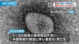 新型コロナで0歳・11歳死亡 2人診察した医師「子どもが急速に重症化するケースも」注意点は | 鹿児島のニュース|MBC NEWS|南日本放送