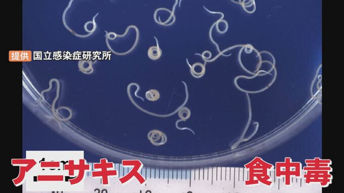 スーパーで買った刺身を食べたら…胃の痛みやおう吐などの症状　寄生虫「アニサキス」による食中毒　|　BSSニュース | BSS山陰放送