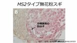 無花粉スギ（MS2タイプ）の候補遺伝子を同定　花粉を作らない原因の解明に前進【森林研究・整備機構森林総合研究所、新潟大学、東京大学、基礎生物学研究所、新潟県森林研究所、岡山大学の研究グループ】|TBS NEWS DIG