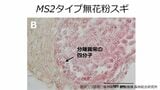 無花粉スギ（MS2タイプ）の候補遺伝子を同定　花粉を作らない原因の解明に前進【森林研究・整備機構森林総合研究所、新潟大学、東京大学、基礎生物学研究所、新潟県森林研究所、岡山大学の研究グループ】|TBS NEWS DIG