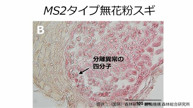 無花粉スギ（MS2タイプ）の候補遺伝子を同定　花粉を作らない原因の解明に前進【森林研究・整備機構森林総合研究所、新潟大学、東京大学、基礎生物学研究所、新潟県森林研究所、岡山大学の研究グループ】|TBS NEWS DIG