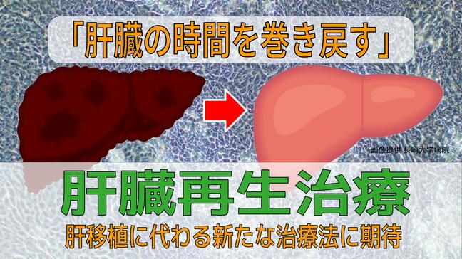 「肝臓の時間を巻き戻す」世界初の挑戦　長崎大学が肝細胞を“若返らせる”再生医療を開始 肝移植に代わる新たな選択肢として期待|TBS NEWS DIG