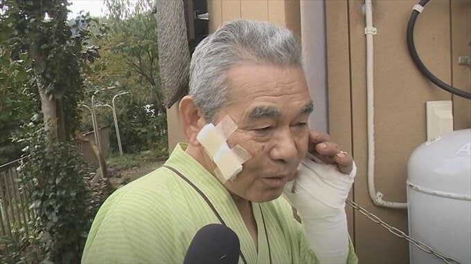 クマに襲われた72歳の男性　必死の抵抗で九死に一生　命を救ったモノは小さな仕事道具　|　山梨のニュース | ＵＴＹテレビ山梨