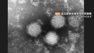 マダニ感染症「SFTS」 愛知で8人目の感染者 発熱や倦怠感の症状で医療機関を受診 マダニは秋まで活発…もし噛まれたら速やかに医療機関へ | 名古屋・愛知・岐阜・三重のニュース【CBC news】 | CBC web