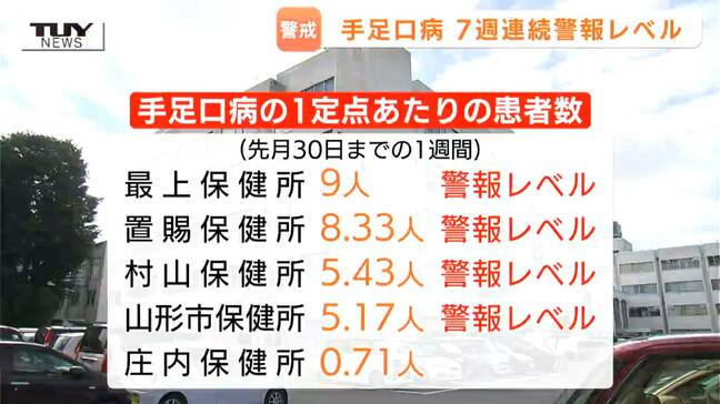 手足口病 県全体で7週連続警報レベル アルコールが効きにくいウイルス…石けんでの手洗いなどで予防を(山形)|TBS NEWS DIG