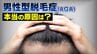 AGAによる薄毛に「男性ホルモンの量」「ストレス」は無関係？本当の原因は “DHT感受性”  「1本の髪から1000本の髪を作る」最新研究も【医師が解説】　|　富山のニュース｜天気・防災｜チューリップテレビ