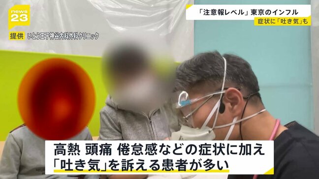 東京都 季節性インフルエンザの患者数が「注意報レベル」に 患者は前週の約2倍|TBS NEWS DIG