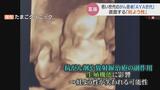 子どもが欲しいがん患者が直面する「妊よう性」 精子卵子の凍結保存に助成制度も 医療現場に広がる支援 富山|TBS NEWS DIG