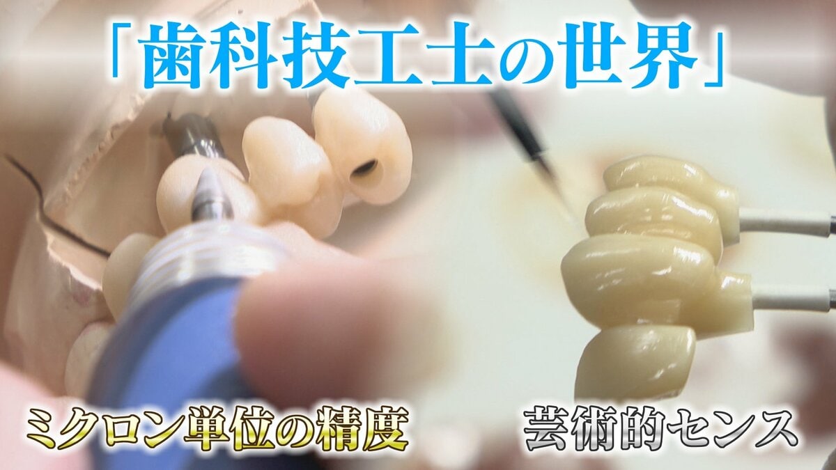 “入れ歯難民”に？減り続ける歯科技工士 現役の約半数が50歳以上 デジタル普及しても…かみ合わせはやっぱり“人間の手”