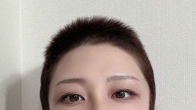 【がんサバイバー】西丸優子さん "頭頂部の髪だけずっと上" "英兵の帽子になりそう" 抗がん剤での脱毛から徐々に回復|TBS NEWS DIG