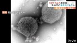 子ども感染症「RSウイルス」 コロナ禍経て秋から夏へ流行期が以降…対策は? | 愛媛のニュース - Nスタえひめ|あいテレビは6チャンネル
