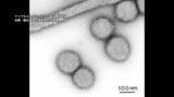 沖縄県がインフルエンザ注意報を発表　定点当たり10.34人で基準値超え　|　沖縄のニュース｜RBC 琉球放送