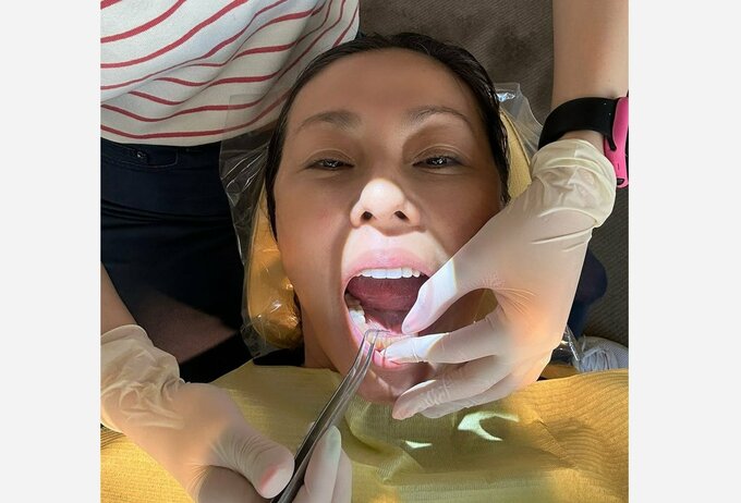 【 RIKACO 】　歯の矯正が完了　「こんな顔でごめんなさい　でもね　嬉しくてー」「長年下の歯並びが悪くて悩みだったの」|TBS NEWS DIG