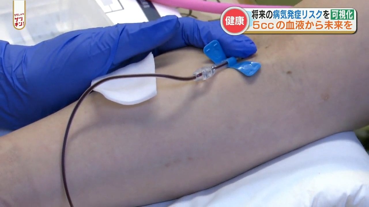 5ccの採血だけで「将来の病気発症率」を知ることが出来る! 心筋梗塞・脳卒中・肺がん・認知症も | TBS NEWS DIG