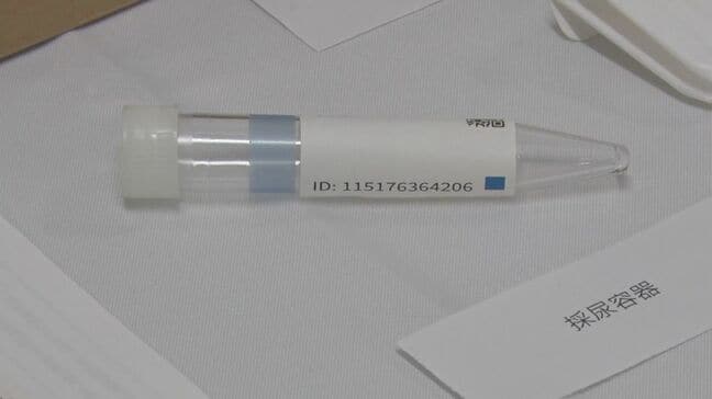 10種類のがんリスクを採取した尿で判定する検査 早期発見・治療のため費用の一部を島根県美郷町が補助|TBS NEWS DIG