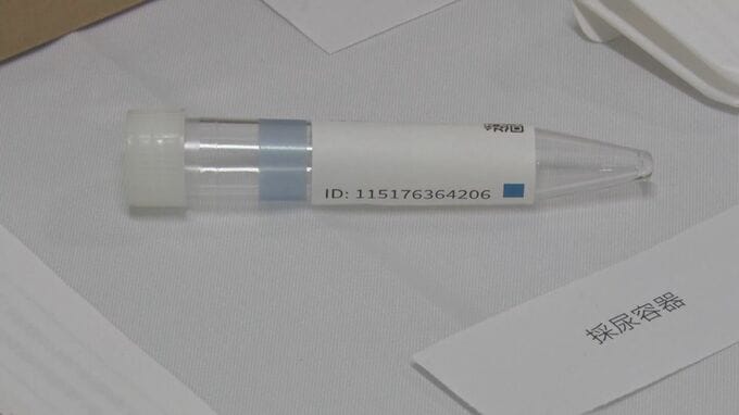 10種類のがんリスクを採取した尿で判定する検査　早期発見・治療のため費用の一部を島根県美郷町が補助|TBS NEWS DIG