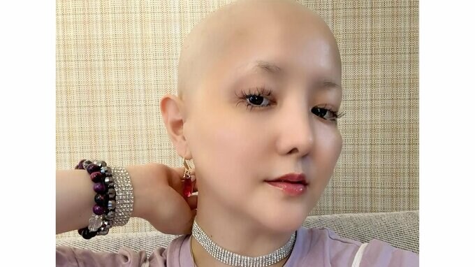 【がん闘病】希良梨さん　「抗がん剤治療が終わった後も定期的に病院には行き、検査はしていくとは思いますが、坊主・スキンヘッドだけは継続しようと思ってます」抗がん剤治療の現況報告|TBS NEWS DIG