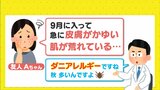 その皮膚のかゆみ･肌荒れやせきの症状… ダニが原因かも　秋に多い「ダニアレルギー」に要注意|TBS NEWS DIG
