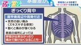 花粉・寒暖差・気圧…“春の7K”で体調不良 突然ズキッ!『ぎっくり背中』にも要注意【ひるおび】|TBS NEWS DIG