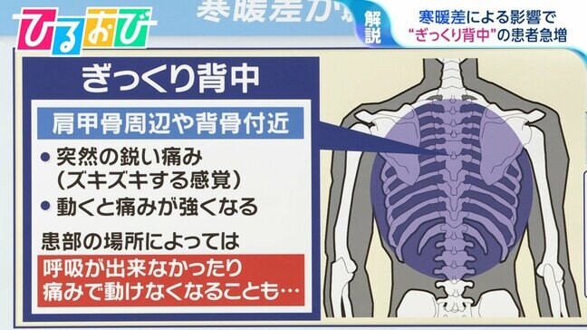 花粉・寒暖差・気圧…“春の7K”で体調不良　突然ズキッ！『ぎっくり背中』にも要注意【ひるおび】|TBS NEWS DIG
