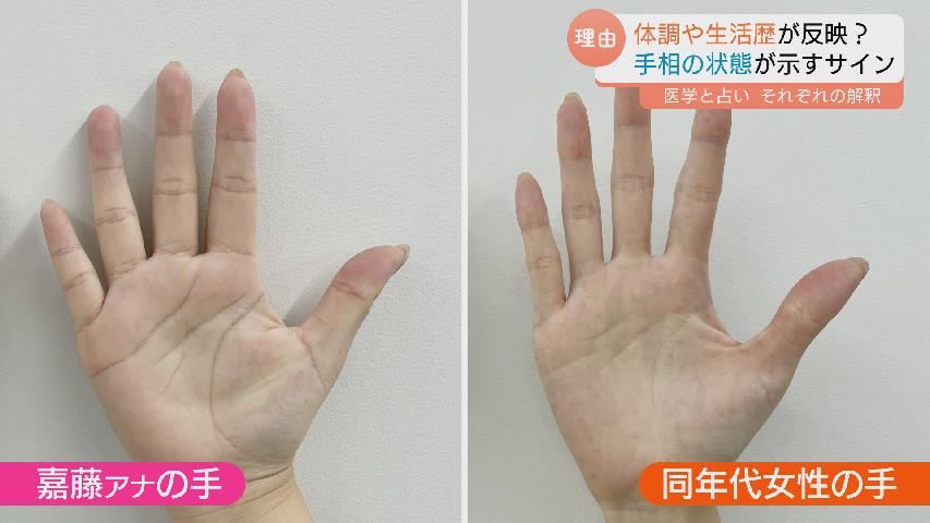 手相が変わる」ってホント？ 運勢をみるだけじゃない！手相が示す健康