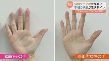 手相が変わる」ってホント？ 運勢をみるだけじゃない！手相が示す健康