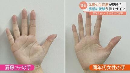 手相が変わる」ってホント？ 運勢をみるだけじゃない！手相が示す健康